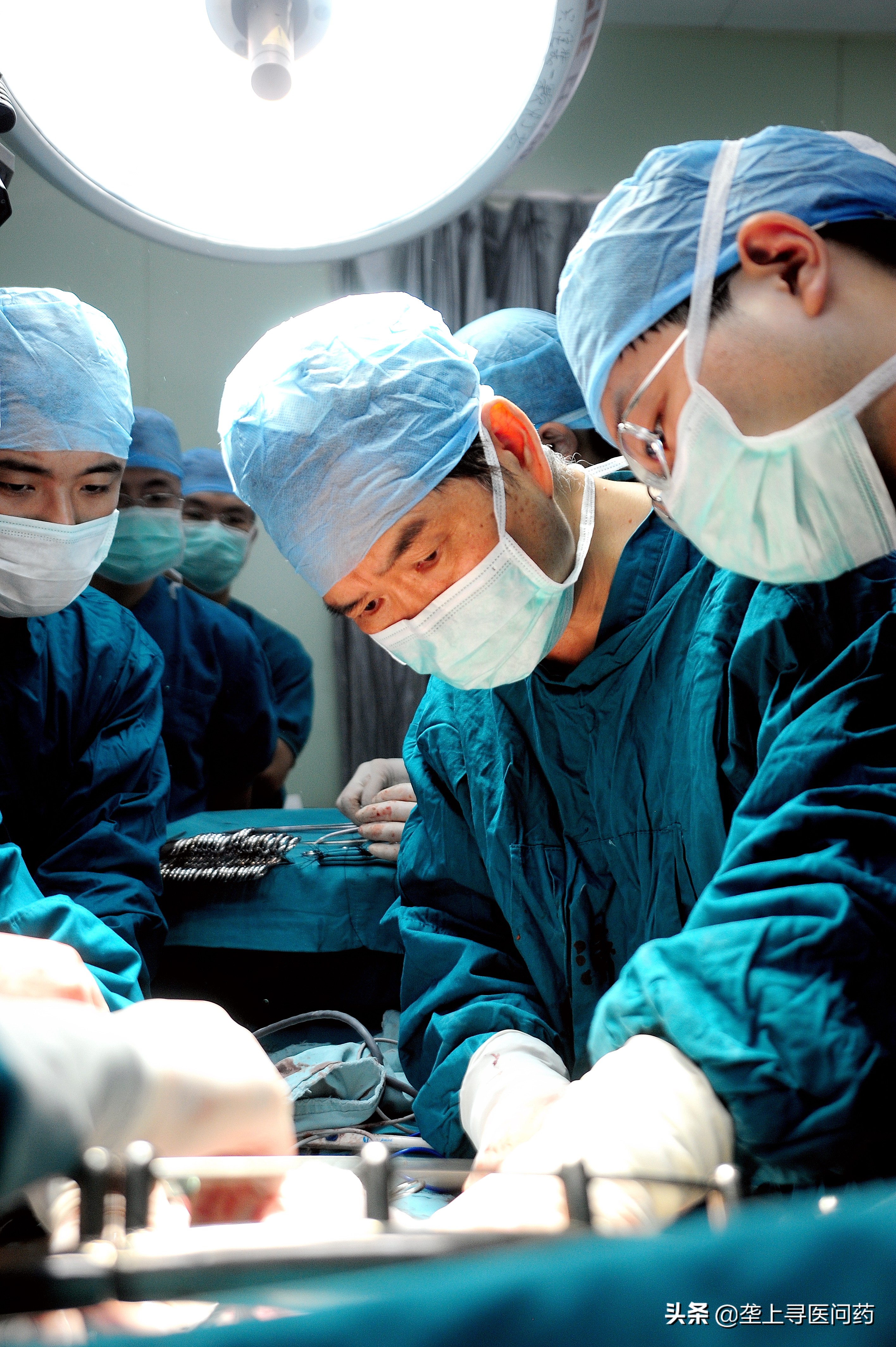 肝脏移植陈孝平院士,肝胆外科陈孝平