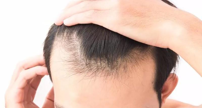 快速增长头发的生发洗发水,发量少用生发洗发水有效吗