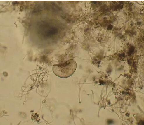 收藏!24种污水处理微生物菌相及指导意义,环保人必看(多图)