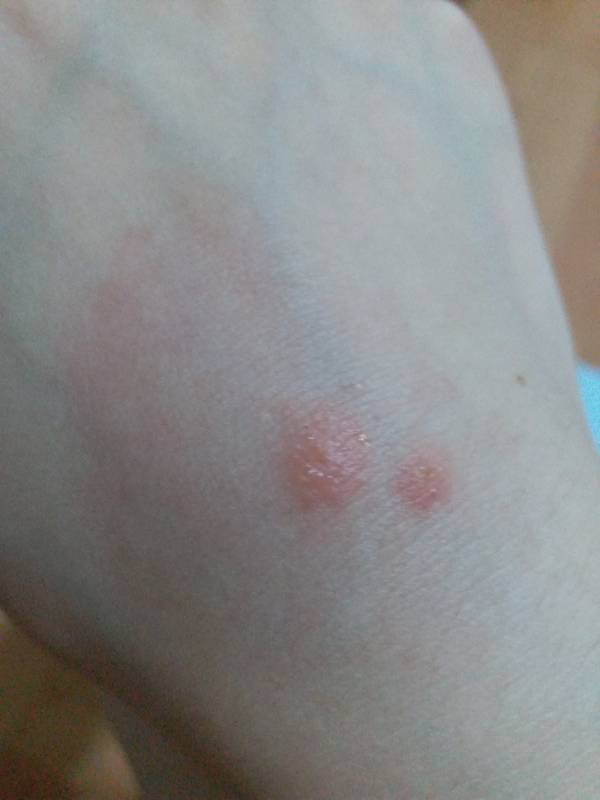 冉莹颖穿10小时高跟鞋，脱鞋后“触目惊心”，女人为了美真是拼了