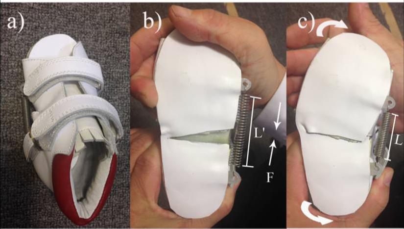 足内翻矫正鞋真的可以矫正吗,马蹄内翻足矫正鞋要穿多久