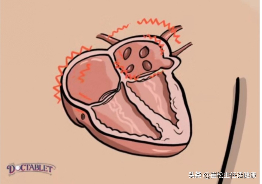 怕热心慌是什么情况,怕热出汗心慌怎么回事