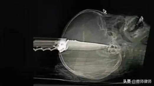 吸食毒粉会给人带来哪些影响,过量吸食毒品最终会导致什么