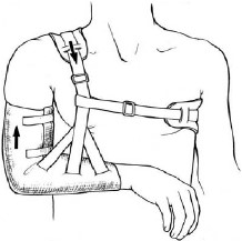 浏阳骨伤科医院髋关节脱位,肩锁关节脱位看骨伤科吗