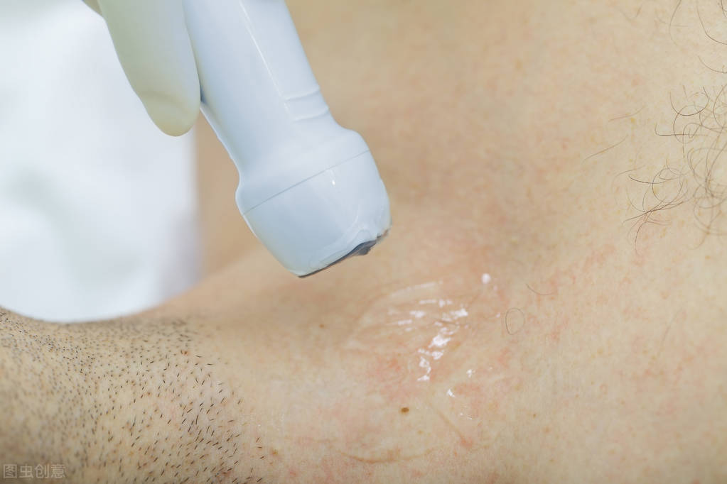 做b超时涂抹的液体是啥,做b超时涂抹的是什么