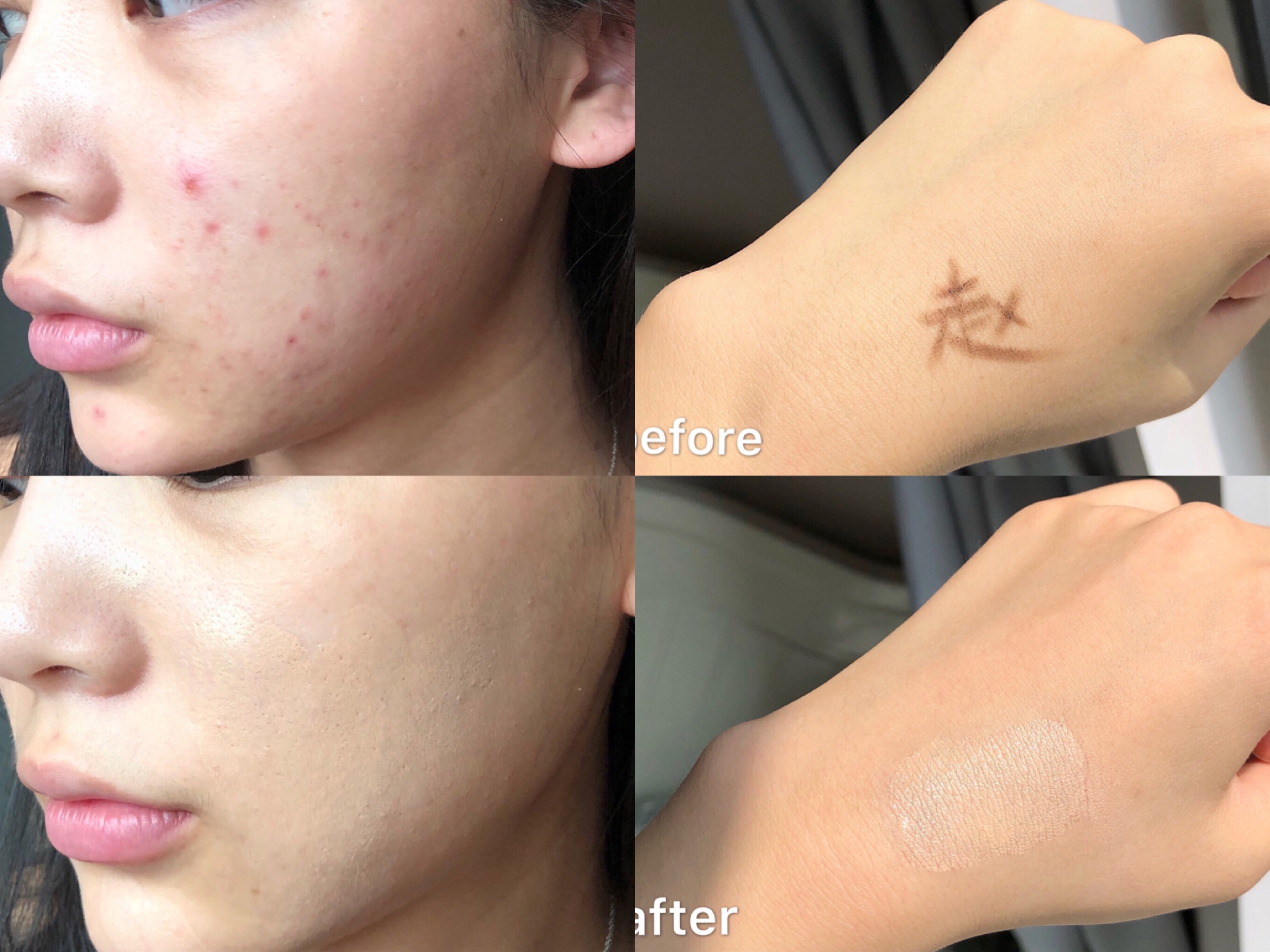 黛玛蔻遮瑕膏真的能遮纹身吗,黛玛蔻小金管遮瑕膏遮纹身好用吗