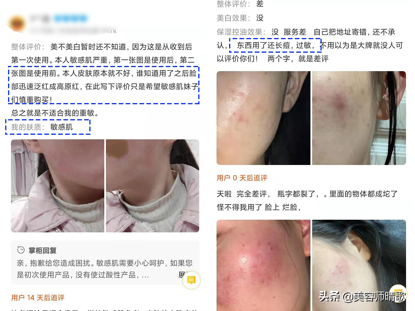 美白淡斑产品拔草,比芭美美白淡斑精华拔草