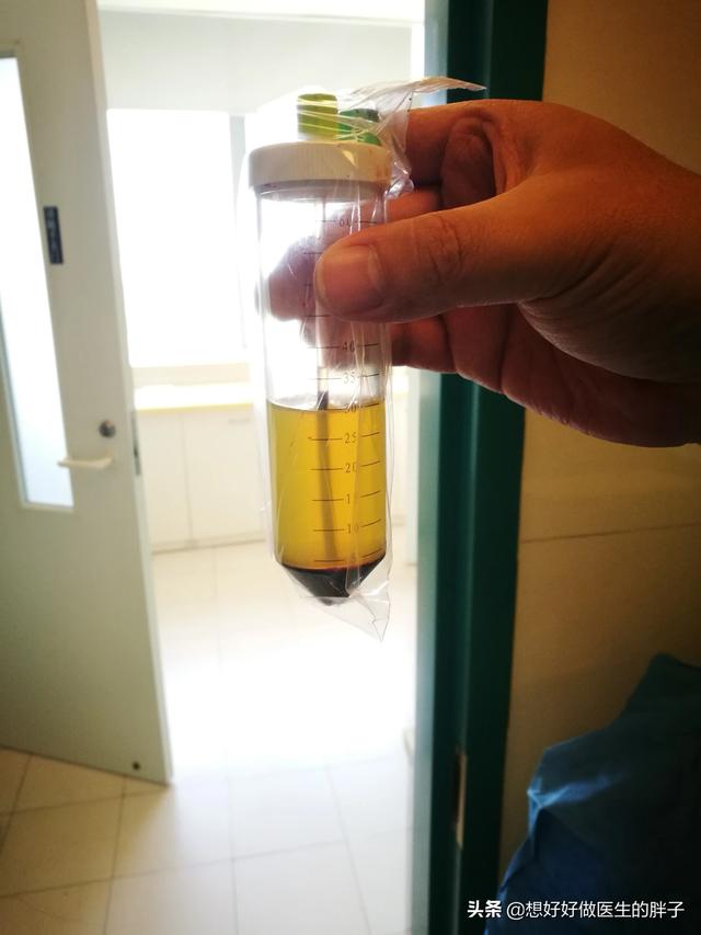 骑自行车膝盖有摩擦的感觉,骑自行车膝盖内侧疼是怎么回事