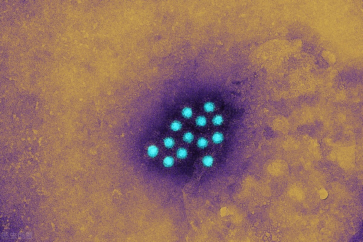 肝病不是绝症乙肝转阴只需2步,丙肝是一种什么肝病