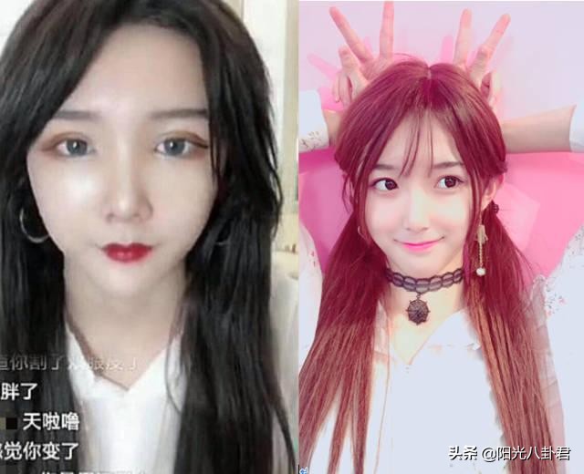 网红艾比做变性手术了吗,网红艾比做手术了吗