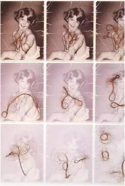 中国七成脱发人群为30岁以下,为什么年轻时不脱发到了30岁脱发