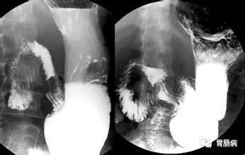 胃不舒服有哪些检查可以做,胃不舒服做什么检查比较好
