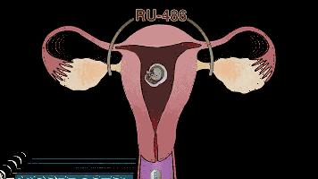 堕胎可怕吗,堕胎到底多可怕