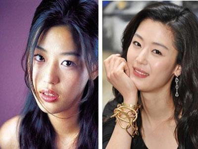 吴宣仪烤瓷牙怎么做,吴宣仪的整牙前