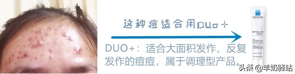 药妆只知道雅漾理肤泉？6大药妆品牌搞定所有肌肤问题！