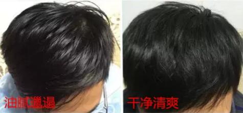 头发蓬松茶树油洗发水,油头救星澳洲茶树洗发水