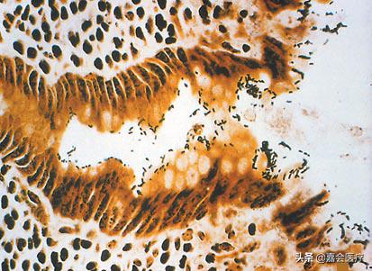 冰淇淋会有细菌么,冰淇淋细菌感染