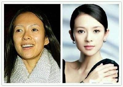 光了嫩肤后皮肤会变光滑吗,皮肤黑光子嫩肤10天变化图片