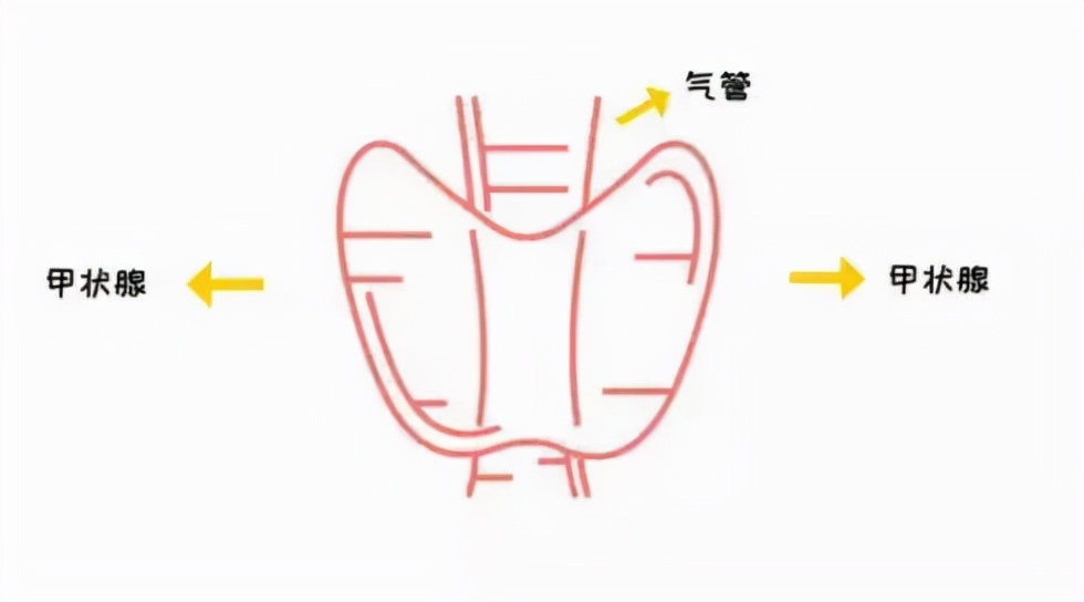年轻人甲状腺影像是什么样子,甲状腺结节是什么样子