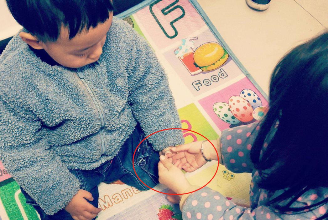 创可贴不能贴什么伤口,宝宝伤口可以贴创可贴吗