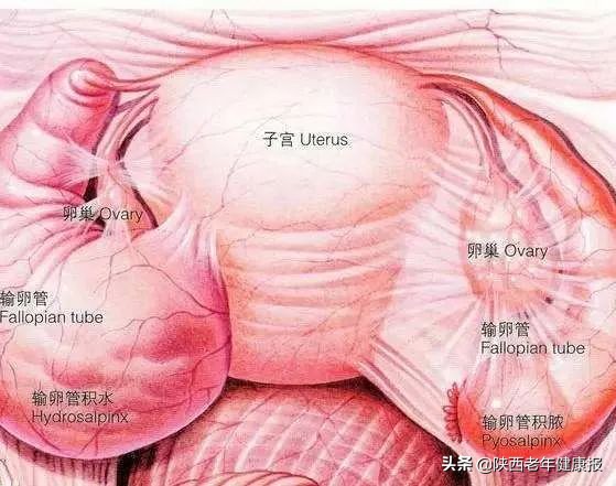 难以受孕，小心藏在体内的“祸水”