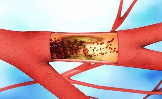 鲟软骨活性肽,鲟鳇鱼软骨蛋白肽的作用