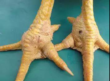 关节肿胀有积液滑膜炎怎么治疗,关节滑膜炎能治好吗