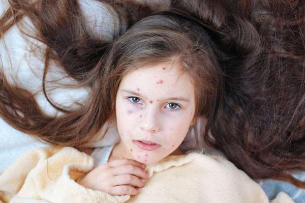 红痘印和黑痘印一起怎么去除,脸上有红痘印和黑痘印