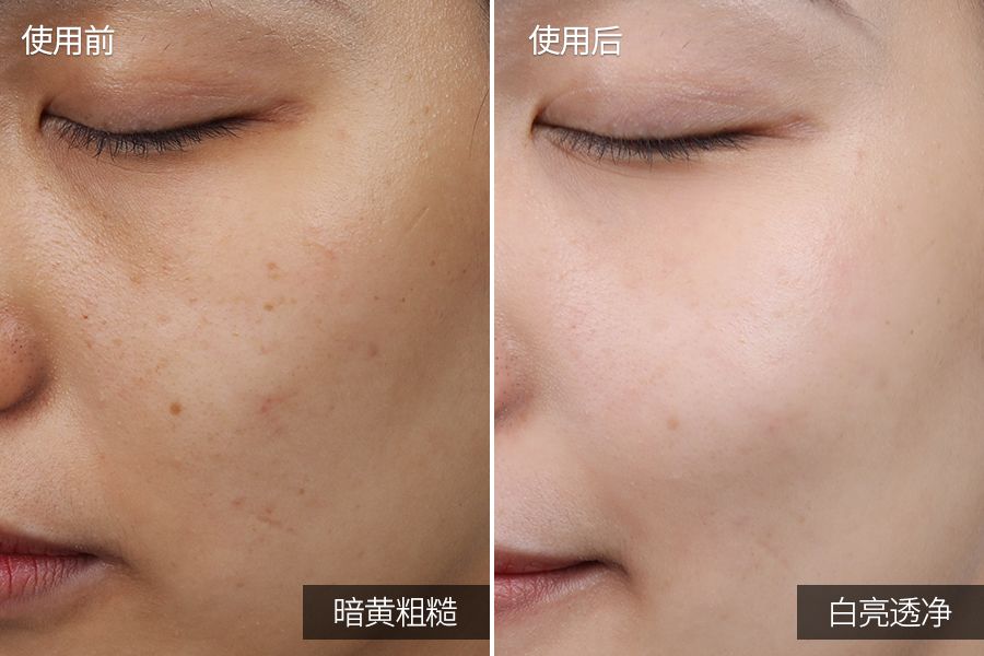 琚佸濮楄憽钀勭苯绮惧崕,琚佸濮楁帹鑽愯憽钀勭苯鎶よ偆