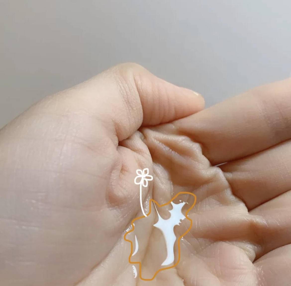 脸上有个光滑不痛不痒的小疙瘩,脸上皮肤粗糙长疙瘩是怎么回事