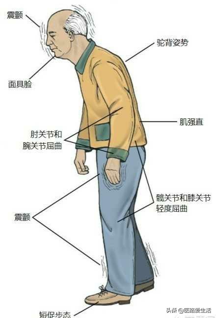 功能性疾病包括哪些,功能性疾病最好的治疗方法