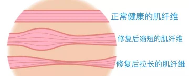 筋膜增肌的正确方法,无论是减脂还是增肌