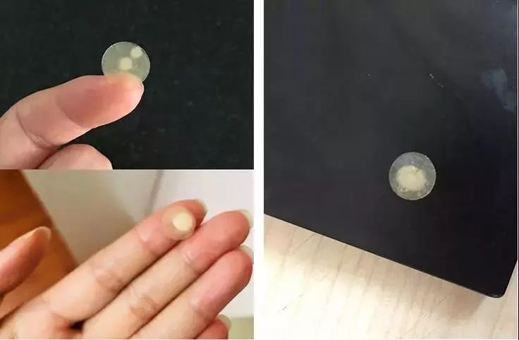 有效祛痘印的痘痘贴,祛痘痘的药膏明星