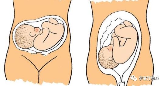 怀孕周刊,孕期周刊第93周