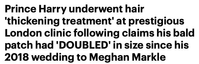 小贝为何剃光头,贝克汉姆的头秃