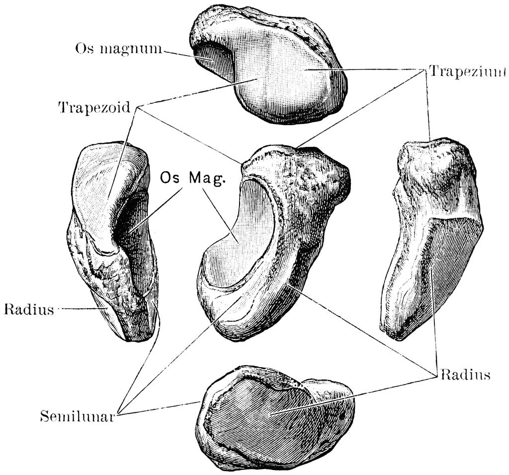 中医治疗腕舟骨骨折,经皮钢板治疗胫骨骨折