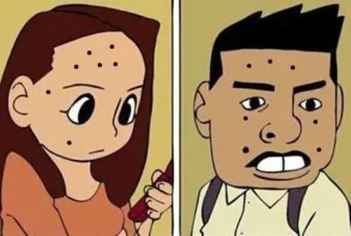 色素痣和黑毛痣的区别,黑毛痣是什么东西