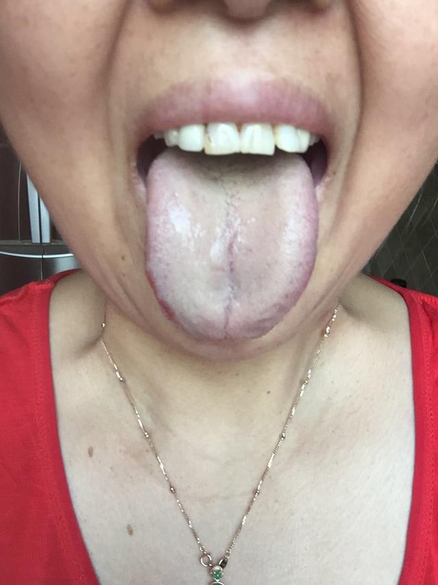 肾虚寒湿证的治法,肾虚湿热症用什么中药调理