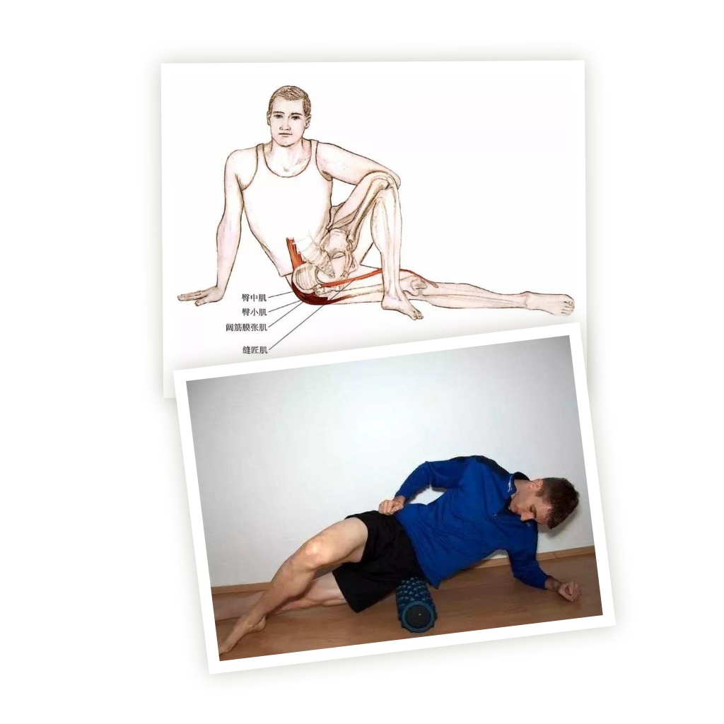 右侧骨盆前倾的最有效的矫正方法,下交叉综合症骨盆前倾矫正