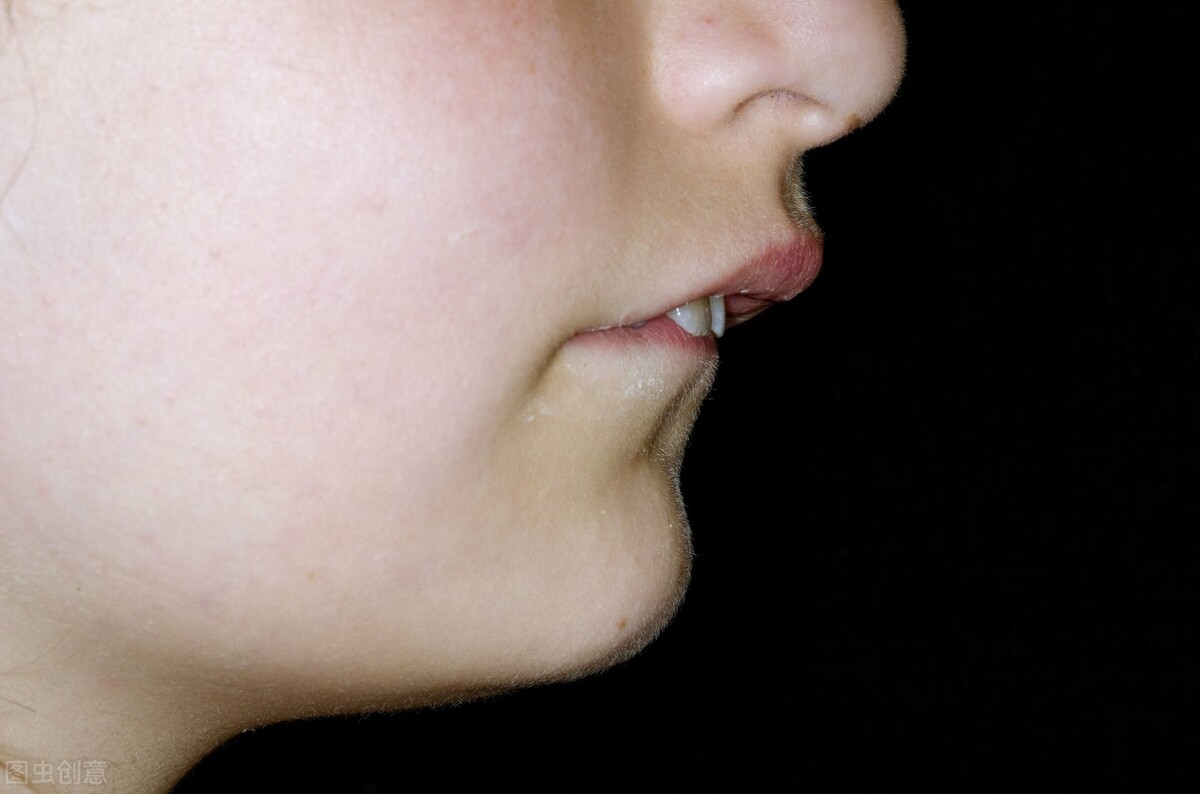 儿童牙齿外凸导致的嘴突怎么矫正,孩子牙齿往外突可以矫正吗