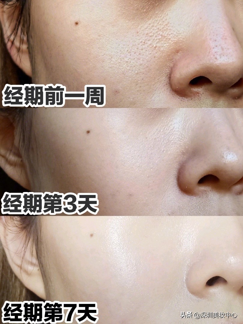 种草美白淡斑,种草皮肤