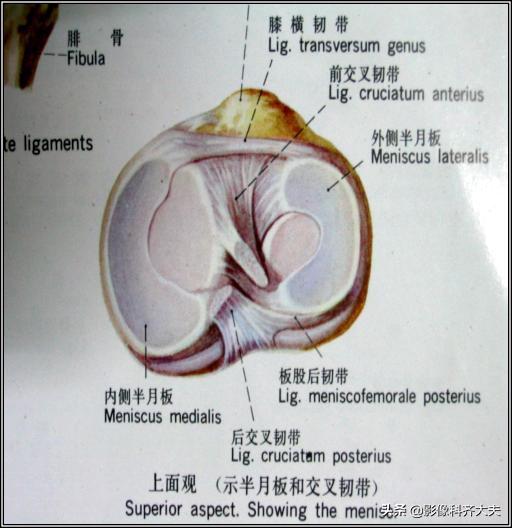 膝关节半月板损伤的磁共振,膝关节半月板病变的mri诊断与鉴别
