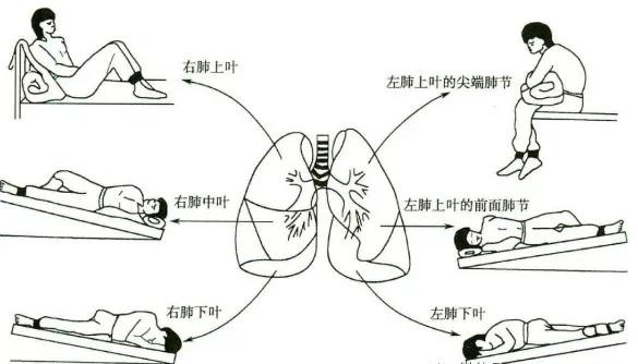 慢阻肺痰如何减少或根除,慢阻肺是痰阻塞气道吗