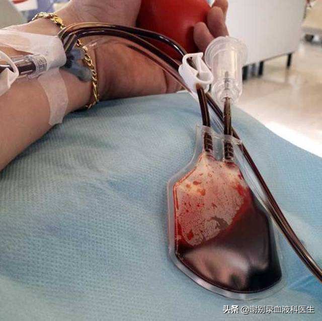 急性失血是指多少毫升,急性失血会引起红细胞减少吗