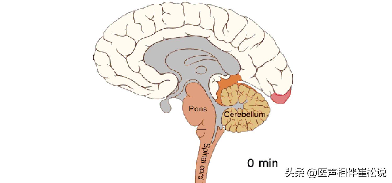 脑梗腔梗应该挂号什么科,腔梗和脑梗有什么区别