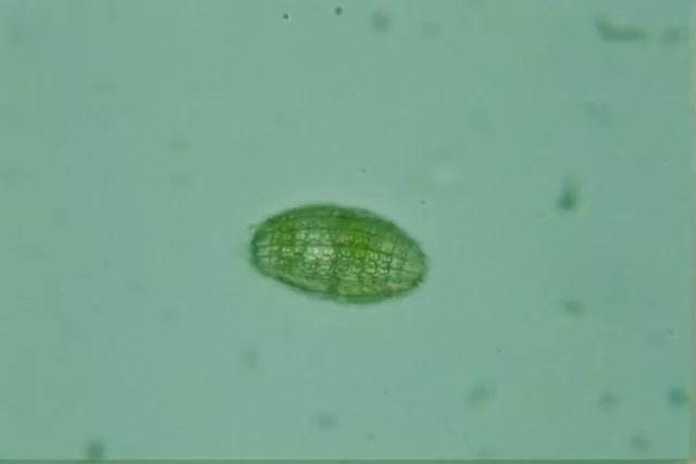 收藏!24种污水处理微生物菌相及指导意义,环保人必看(多图)