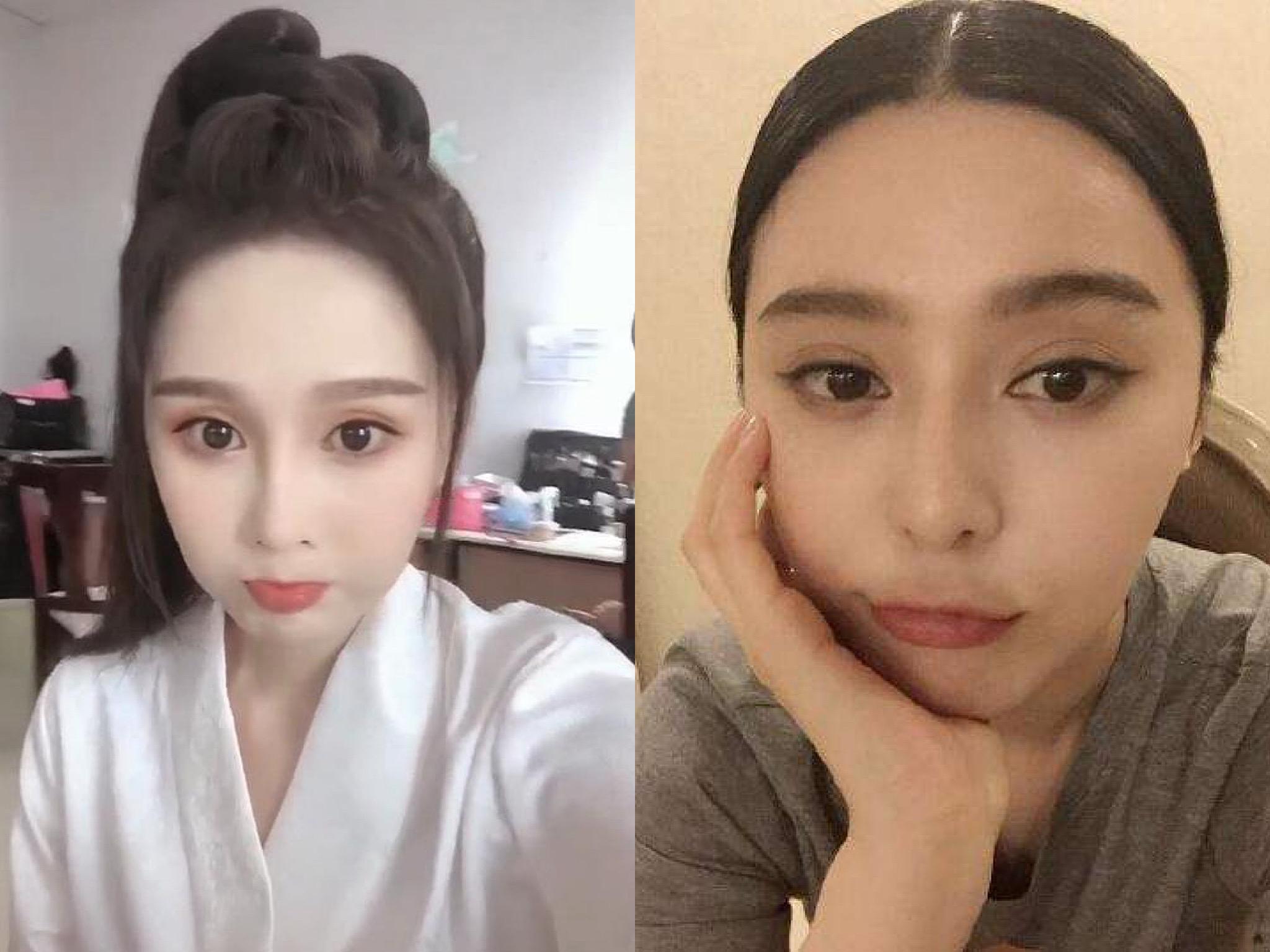 赵本山女儿自曝30万整容,赵本山女儿整容被质疑