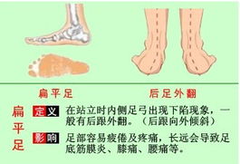 膝反屈的治疗方法,膝反屈是什么意思