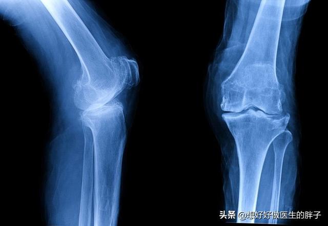 为什么感觉膝盖没力气,为什么感觉膝盖不舒服