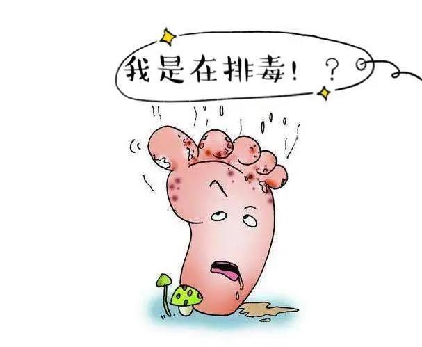 脚气特效药,脚气那些事儿